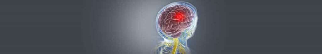An image showing the the growth of tumor inn the brain and the pain caused by it.
