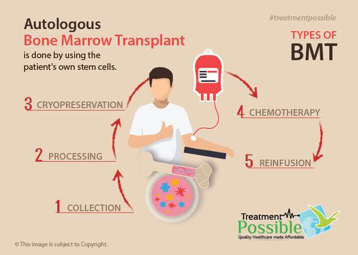 An infographic showing autologous bone marrow transplant procedure