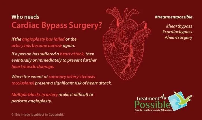 This infographic defines who needs a heart bypass surgery