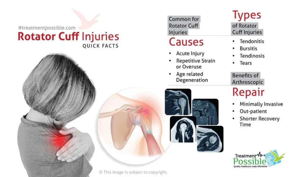 Shoulder Arthroscopy Surgery in India