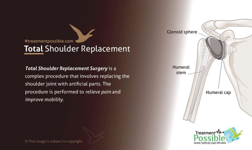 Total Shoulder Replacement surgery in India