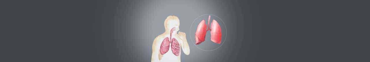 Lung transplantation in India