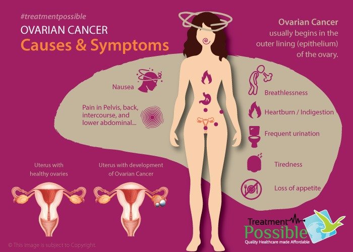 ovarian cancer symptoms