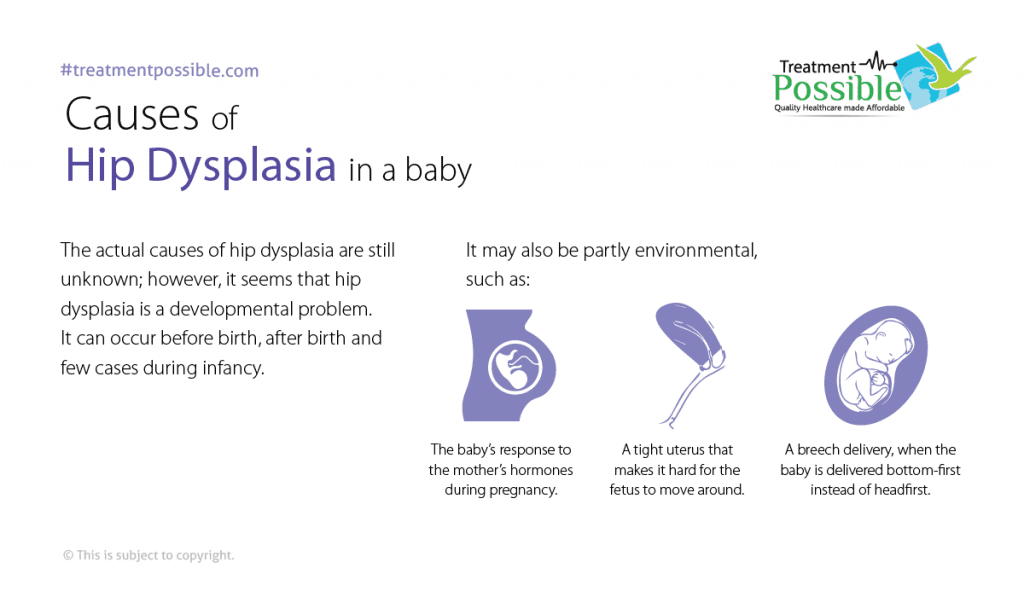 causes of congenital hip dysplasia