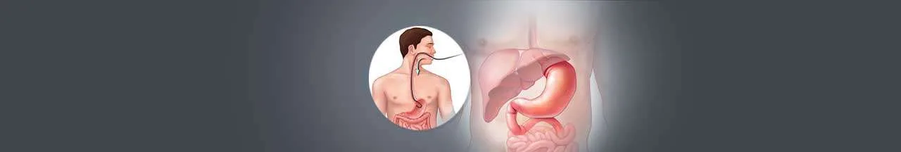 Esophageal cancer treatment