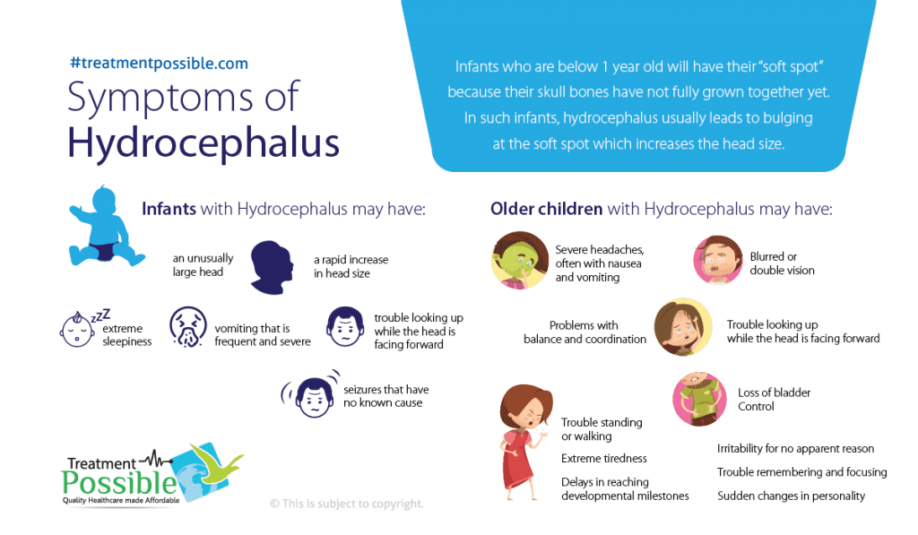Symptoms of hydrocephalus in kids