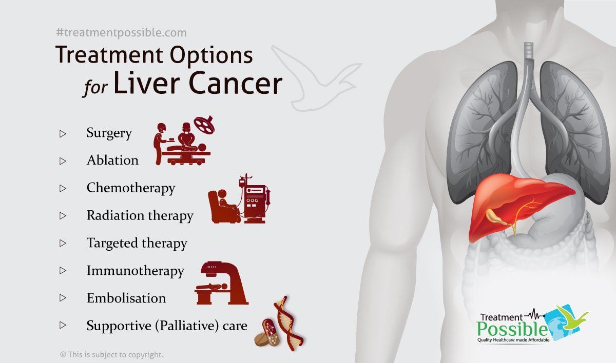 Liver Cancer Treatment Treatment Possible 8817