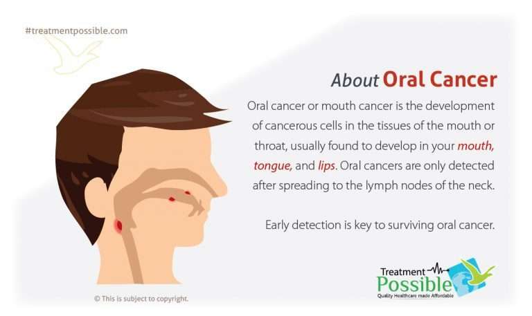 Oral Cancer Treatment | Treatment Possible