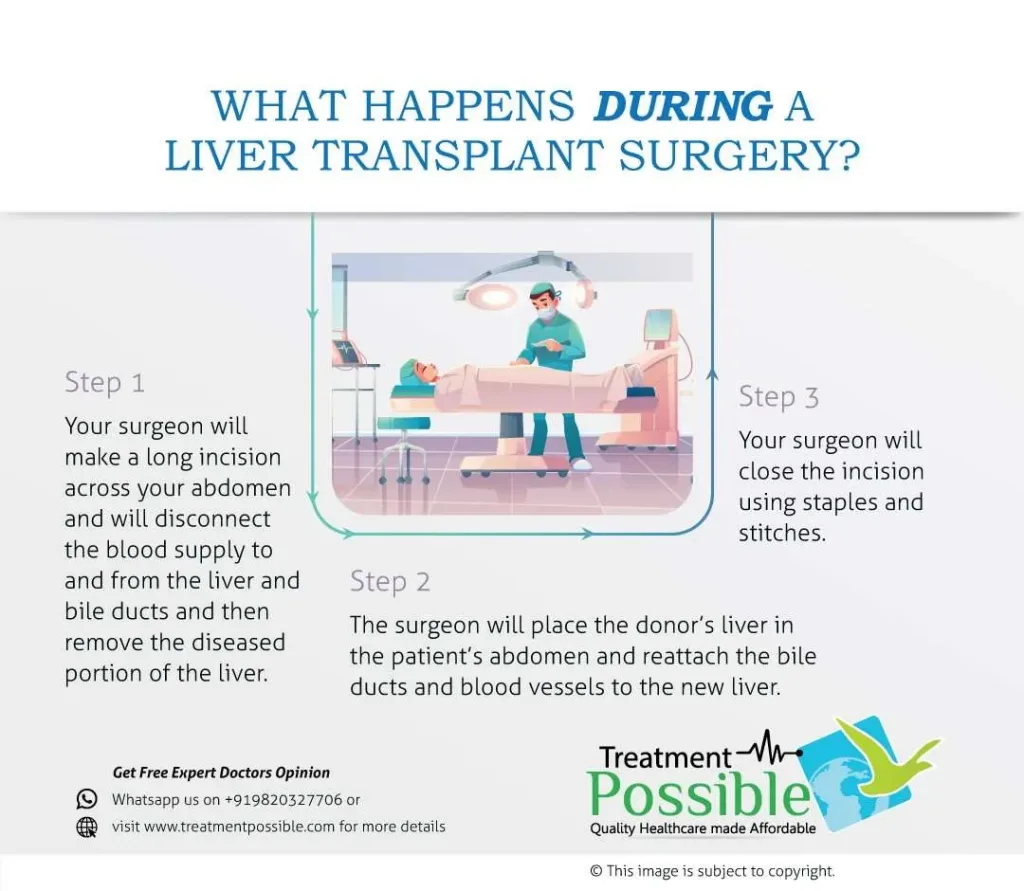 Pediatric liver transplant in india