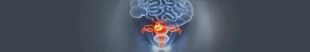 cervical cancer treatment in India