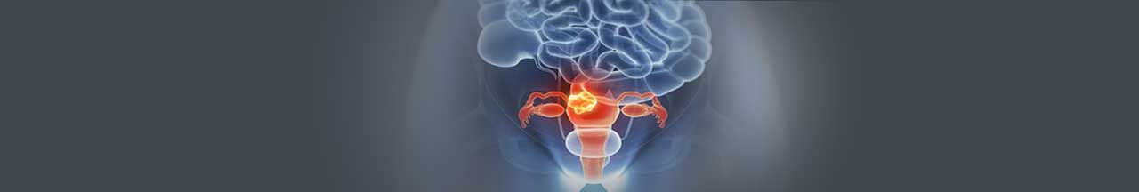 cervical cancer treatment in India