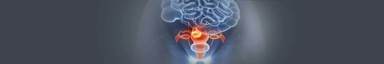 cervical cancer treatment in India